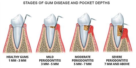 adonitologia wikipedia|Periodontology .